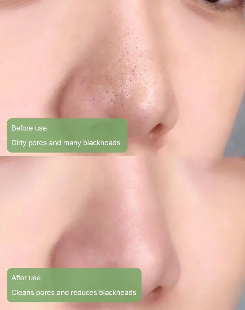 100% Natural Green Tea Deep Cleanse Mask - Image 5