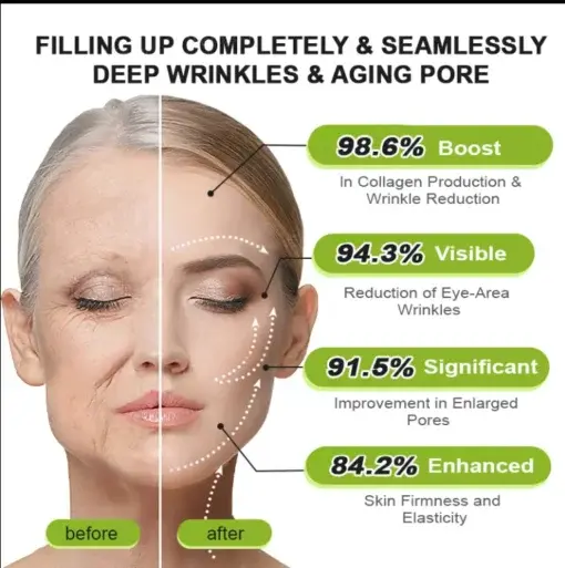 Botox Vitamin A Retinol Anti-Wrinkle Firming and Lifting Cream Last Day for Limited Time 70 OFF - Image 8