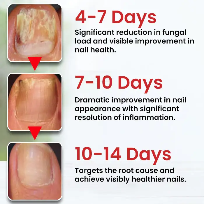 LOVILDS Fungi-Cure Max Triple-Action Formula - Image 4