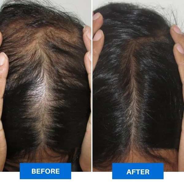 - Smart Scalp Massager - Image 6