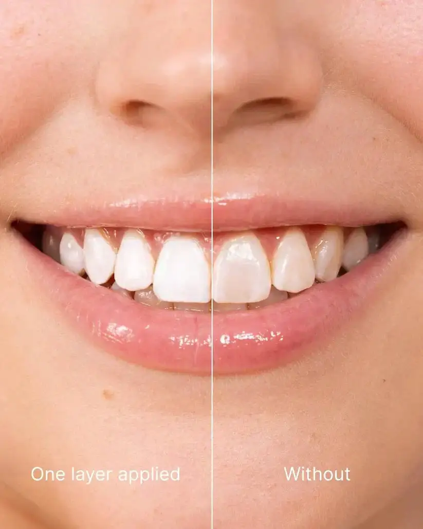 Tooth Polish - Instant Clean Smile - Image 6