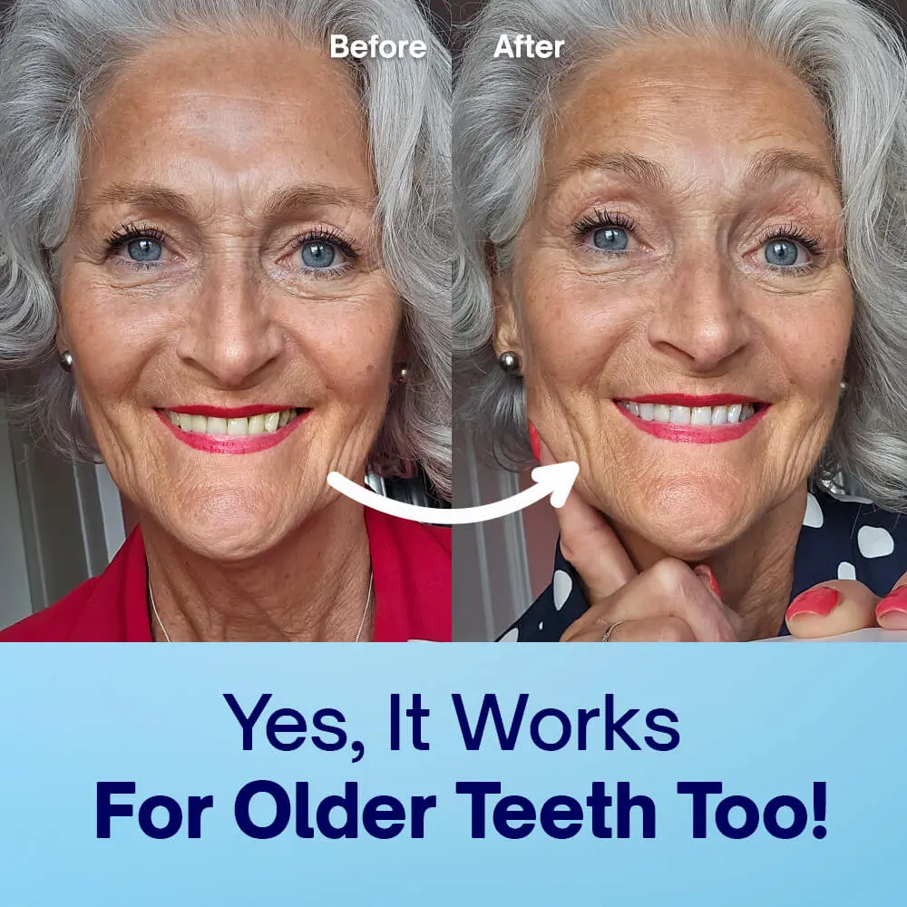 Teeth Whitening Powder - Image 6