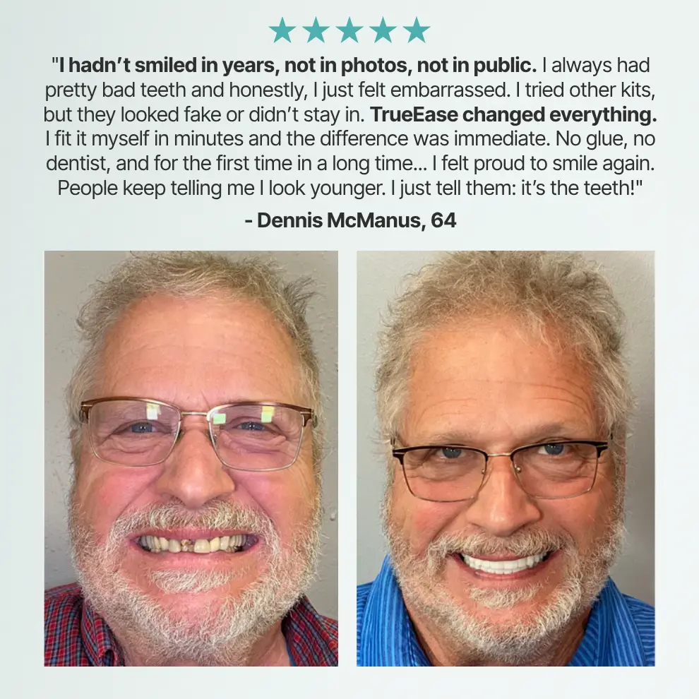 Custom-Fit Full Functional Dentures - Image 6