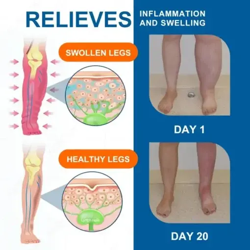 Advanced Lymphatic Drainage Massage Cream - Image 4