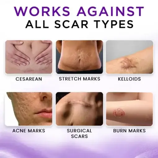 Cure Face & Body Scar Gel - Image 6