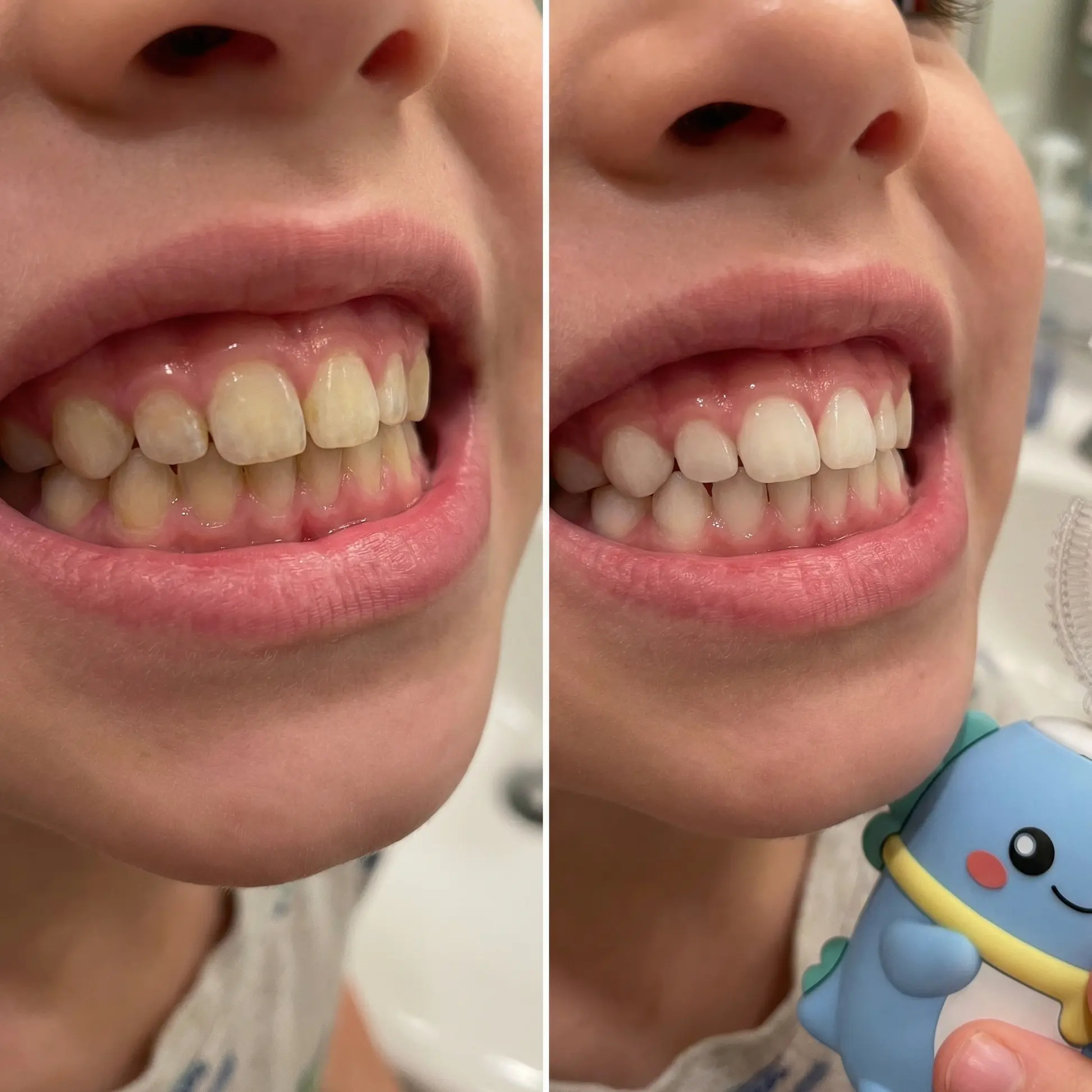 Children's Electric Toothbrush - Fun, Effective, and Kid-Approved! 🦷 - Image 3