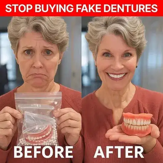 Custom-Fit Full Functional Dentures - Image 2