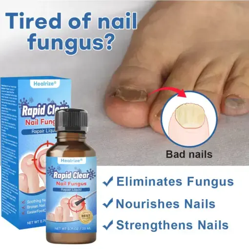 Nano Rapid Clear Nail Fungus Rapair Liquid Effective in Seven Days, Permanently Eliminates the Root - Image 10
