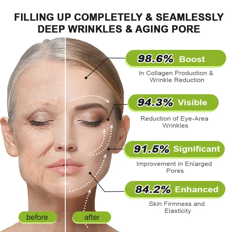 🇺🇸 Made and shipped from the USA Botox & Vita-A Retinol Shot Wrinkle-Lift Tightening cream - Image 16