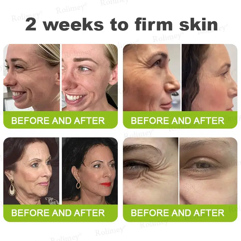 Botox & Vita-A Retinol Shot Wrinkle-Lift Tightening cream - Last Day Promotion 50% OFF - Image 6
