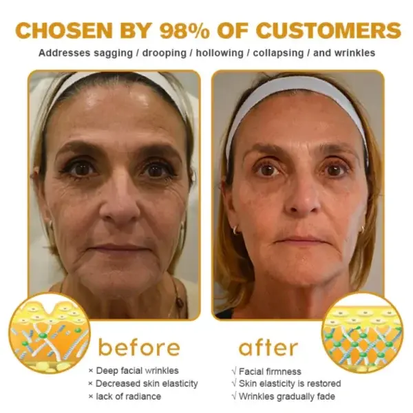 New Year Sale Botox Bee Venom Wrinkle Removal Cream - Image 5