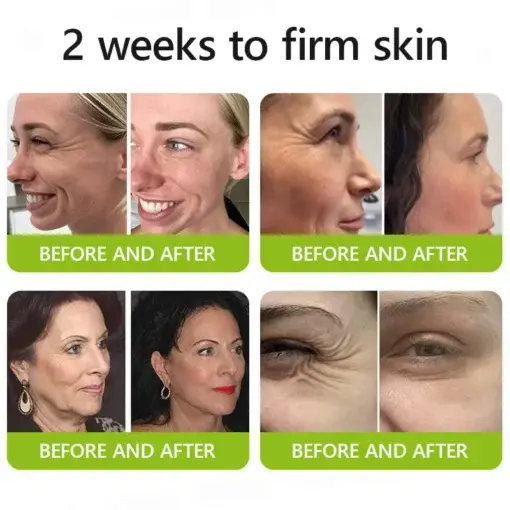 Peptide-Infused Firming Shot Dermatologist-Approved Formula for Powerful Lifting Visibly De-puffing - Image 3