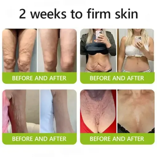 Peptide-Infused Firming Shot Dermatologist-Approved Formula for Powerful Lifting Visibly De-puffing - Image 4