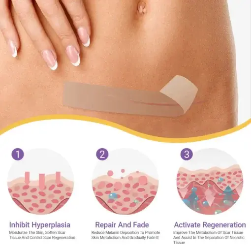 Hyaluronic Acid Nano Microneedle Repair Tape - Image 10