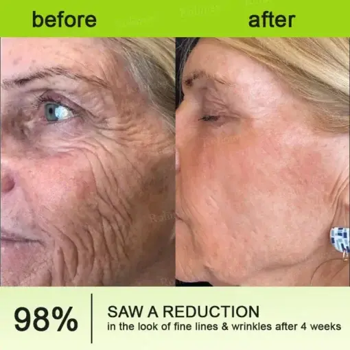 Botulinum Vita-A Retinol Shot Wrinkle-Lift Tightening cream - Image 6