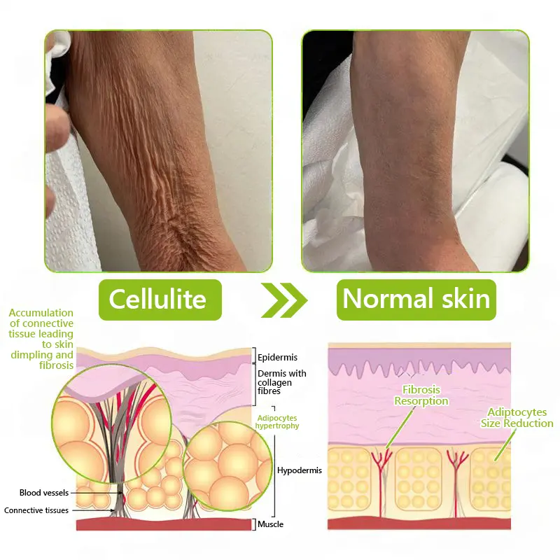 BOTOX & VITA A RETINOL SHOT Wrinkle Lift Tightening Cream - Image 50