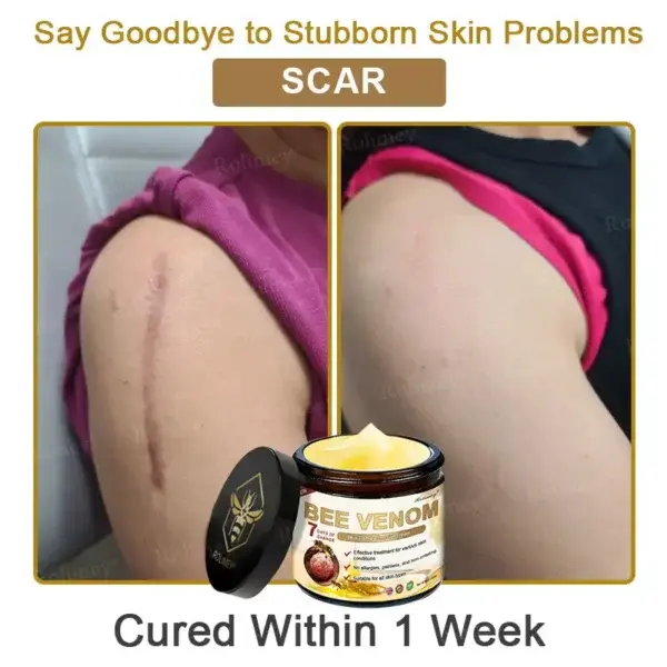 Botox Bee Venom Skin Treatment Cream - Image 10