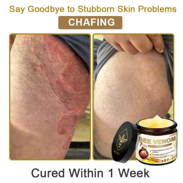 Botox Bee Venom Skin Treatment Cream - Image 7