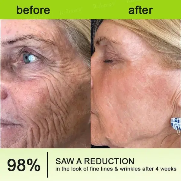 Botox & Vita-A Retinol Firming & Anti-Wrinkle Serum - Image 9