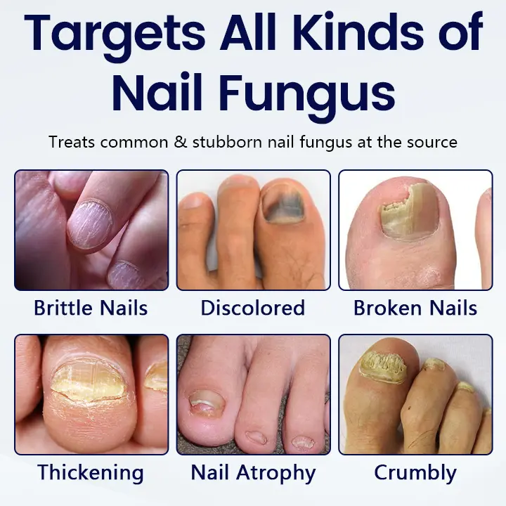 Anti-Fungal Nail Repair Patch - Image 3