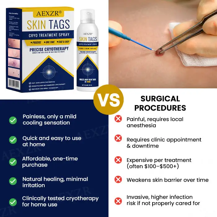 Warts No More - 50% OFF | Skin Tag Cryo Treatment Spray - Image 6