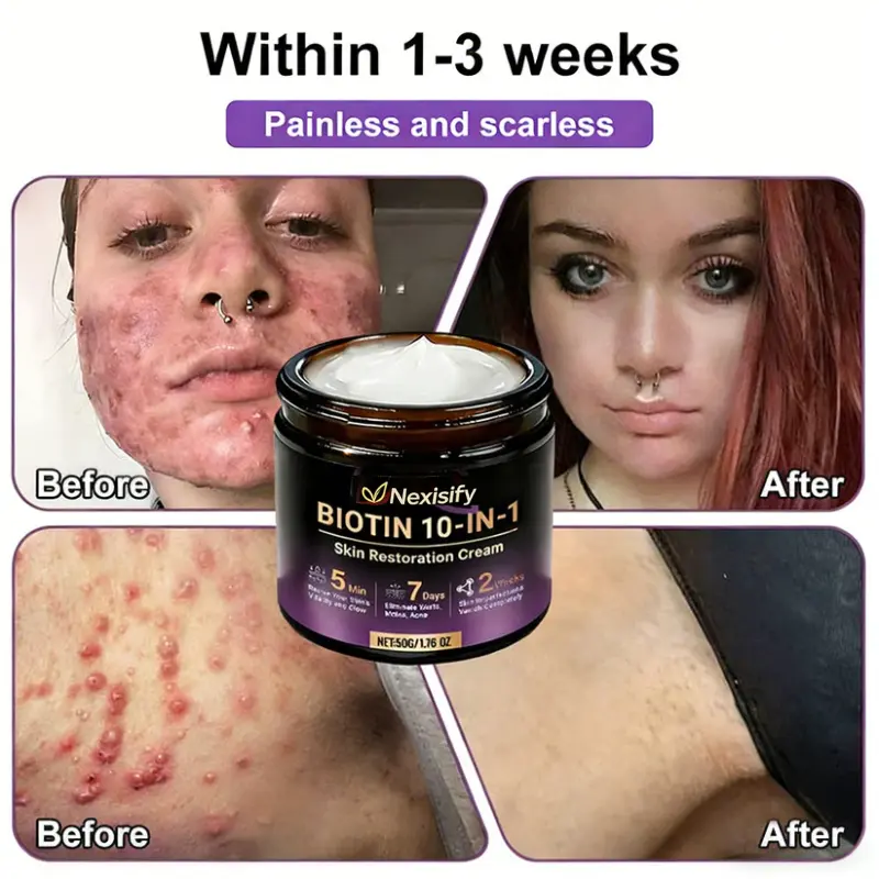 Skin Repair Cream - Image 6