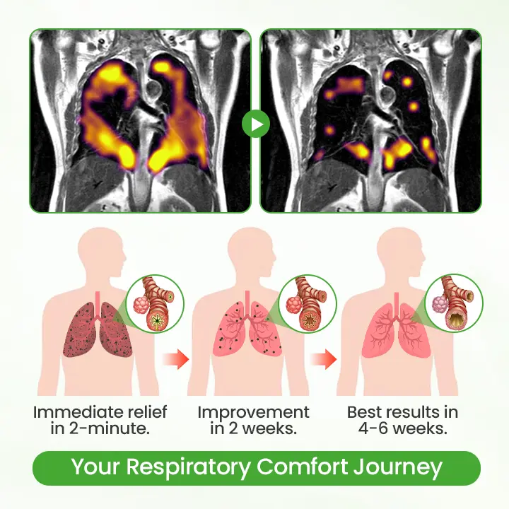 Mulleaf Herbal Lung Purifier - Image 2