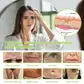 BOTOX & VITA A RETINOL SHOT Wrinkle Lift Tightening Cream - Image 37