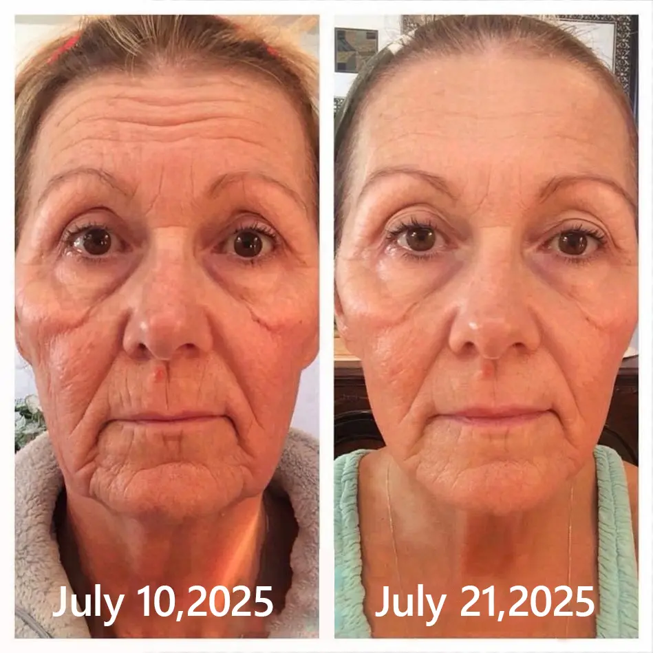 BOTOX & VITA A RETINOL SHOT Wrinkle Lift Tightening Cream - Image 50