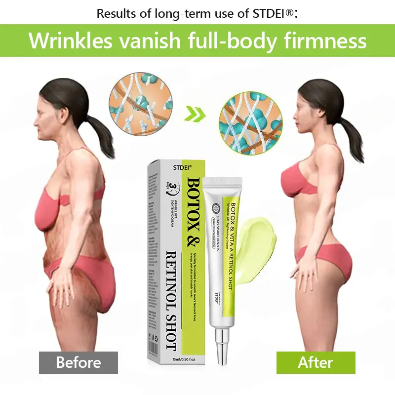 BOTOX & VITA A RETINOL SHOT Wrinkle Lift Tightening Cream - Image 54