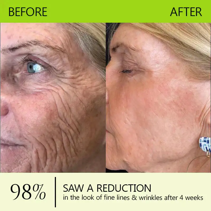 BOTOX & VITA A RETINOL SHOT Wrinkle Lift Tightening Cream - Image 17