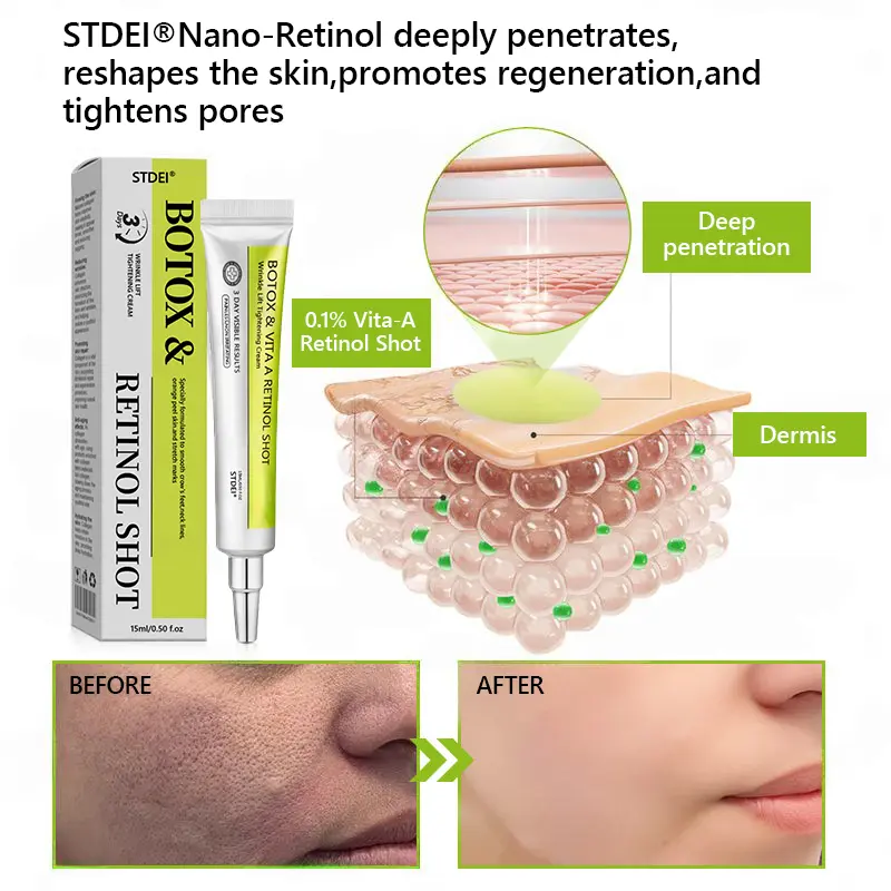BOTOX & VITA A RETINOL SHOT Wrinkle Lift Tightening Cream - Image 60