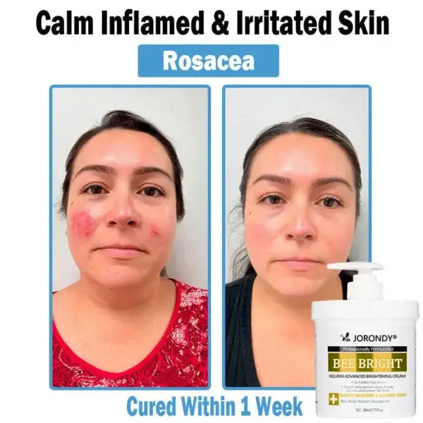 Bee Bright Multi-Symptom Skin Treatment Cream - Image 5