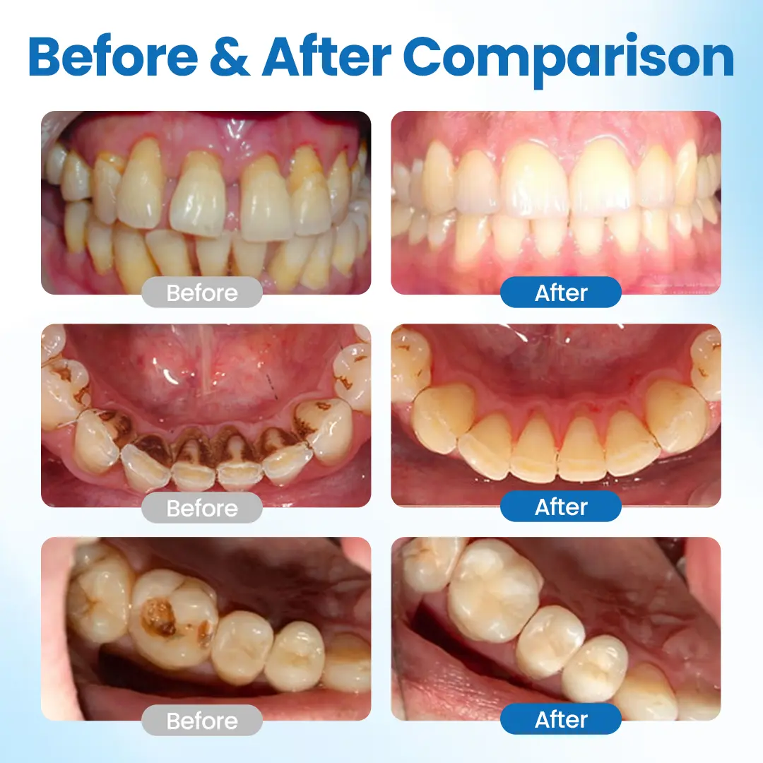 EnaMend Nano-Fusion Tooth Defense Serum - Image 2
