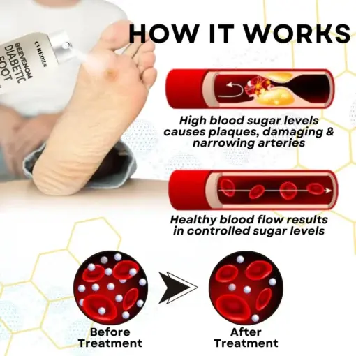Bee Venom Diabetic Foot Healing Spray - Image 8
