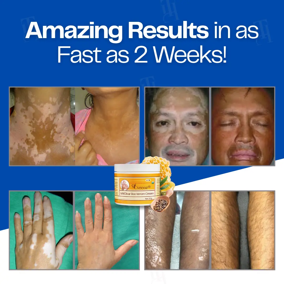 VitiClear Bee Venom Cream - Image 2