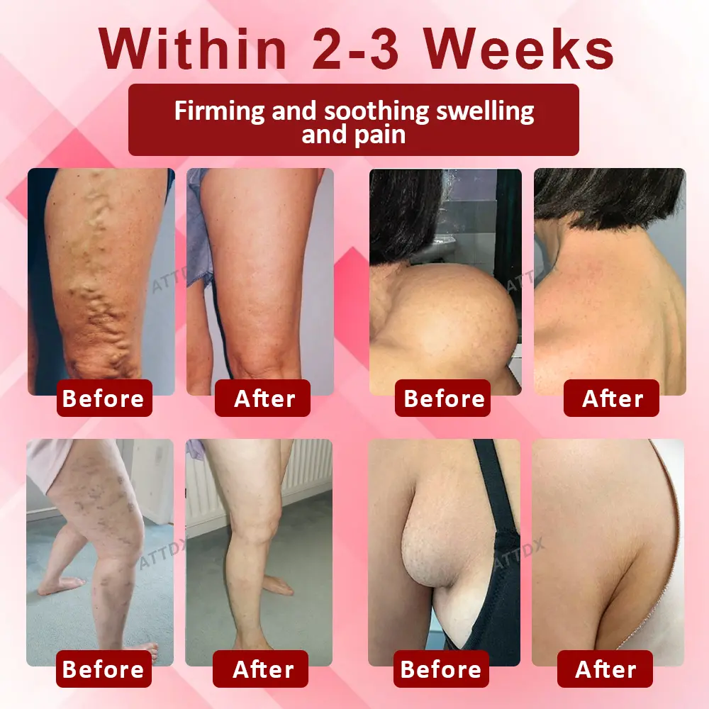 VenoLymph Massage Therapy Cream - Image 2