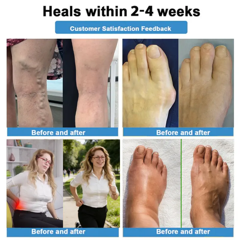 🛒4-in-1 Vein & Joint Nano Microneedle Advanced Therapy Patch🔥 - Image 4