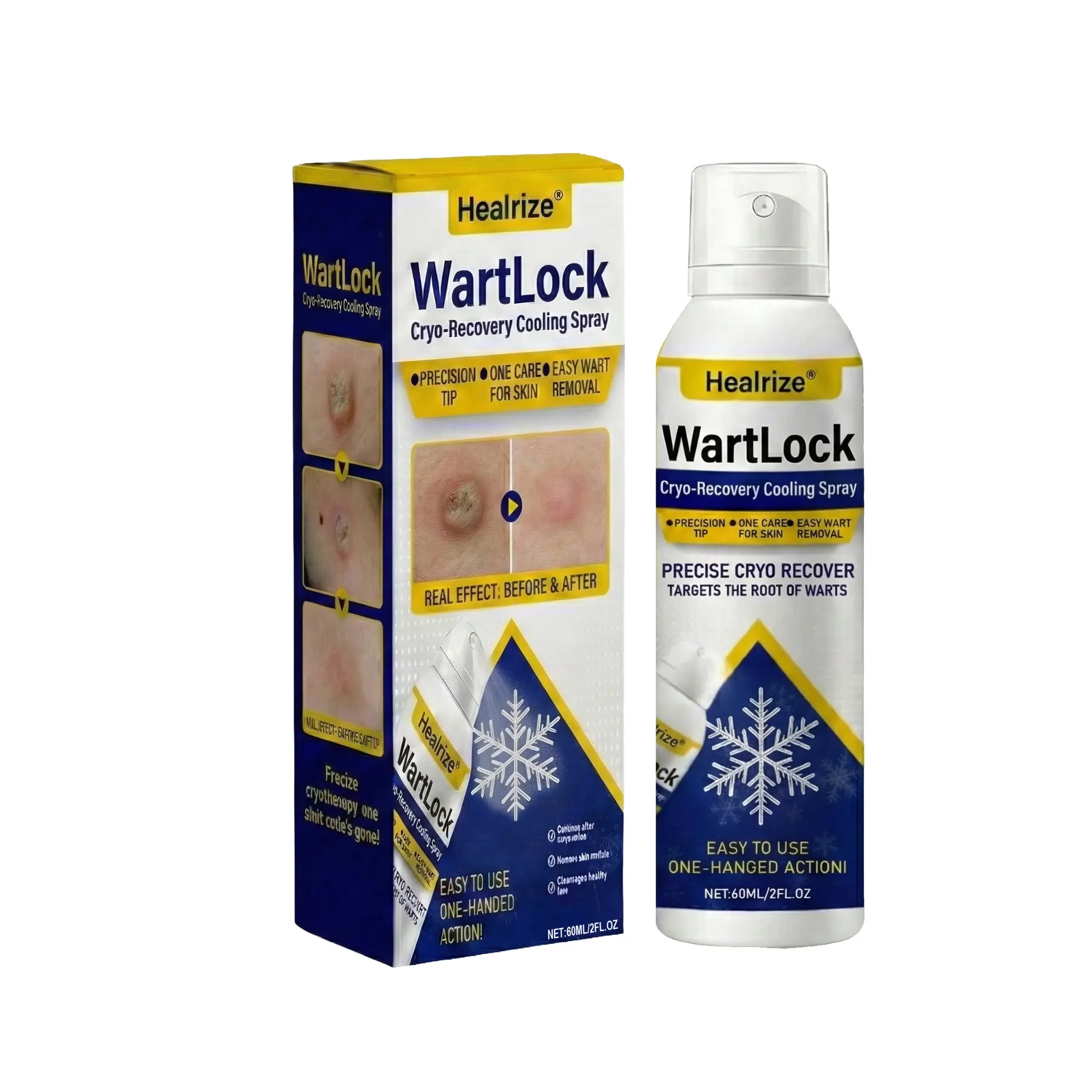 ๐ฅ๐๐๐ง๐๐ ๐๐ฅ๐๐๐๐๐ก ๐๐๐๐๐ง๐จ | WartLock Cryo-Recovery Cooling Spray - Image 8