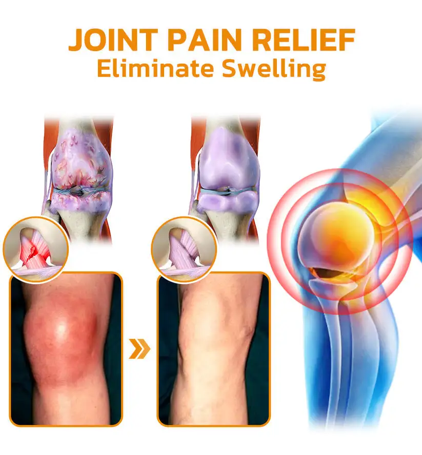 Bee Venom Pain Suppression Joint Healing Cream - Image 7