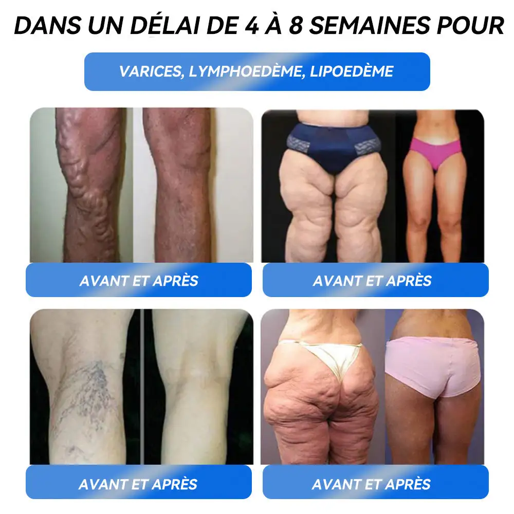 Pro Solution orale pour la perte de poids - Image 4
