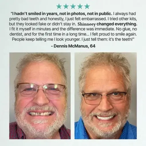 Custom Fit for a Fresh Smile, Say Goodbye to Wearing Discomfort! - Image 11