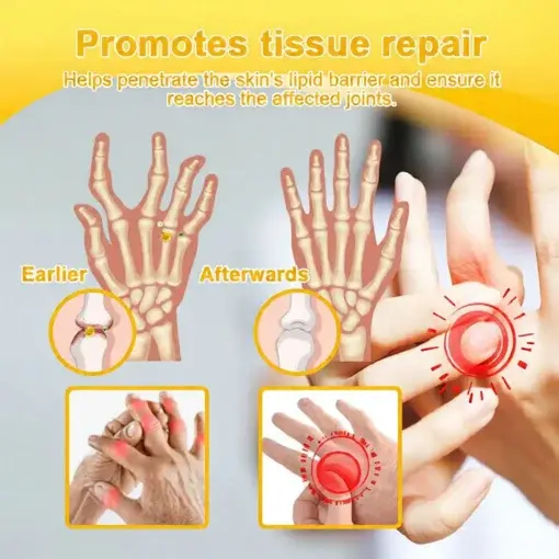 Bee Poison Pain-Relief Bone Healing Cream (Specially for older adults) - Image 13