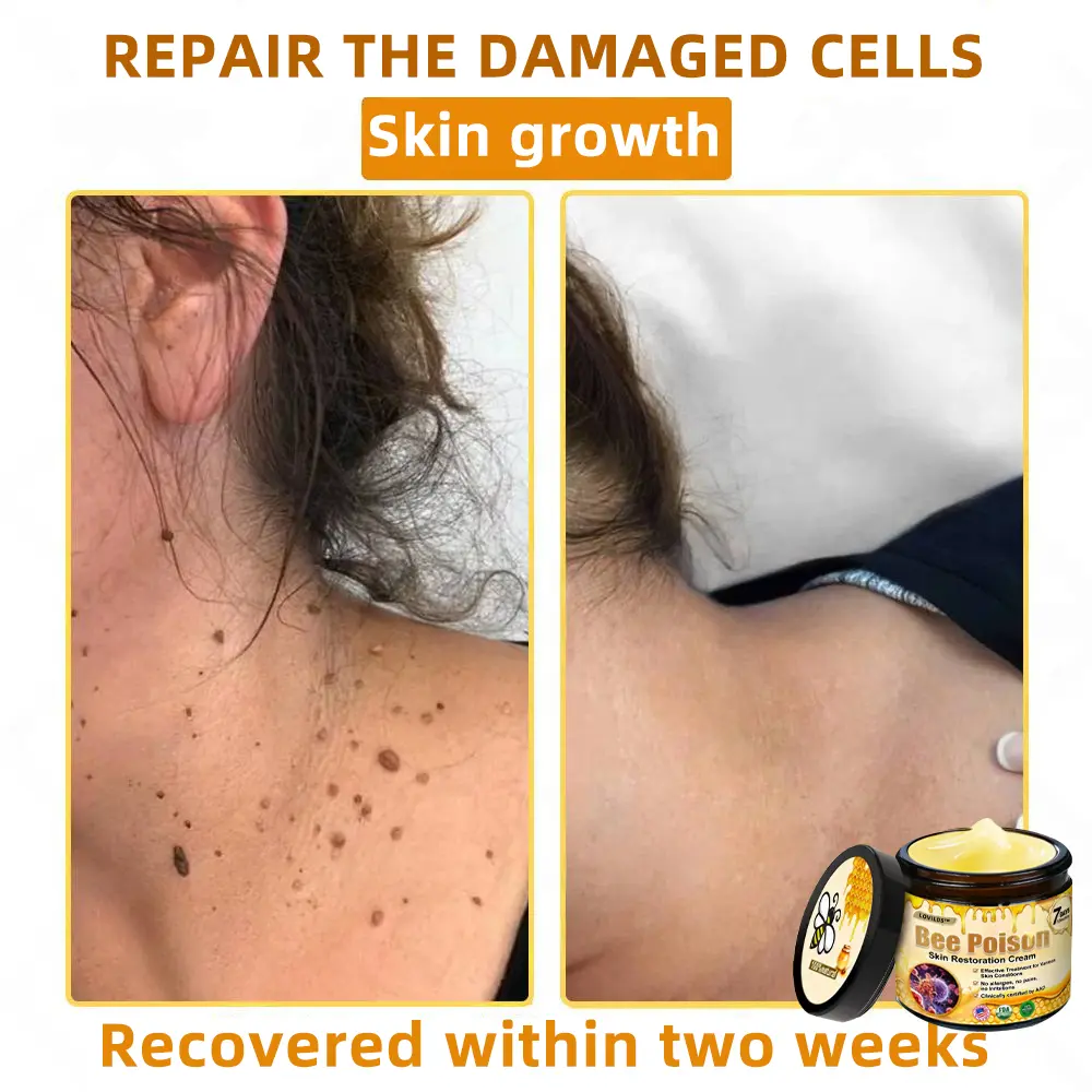 Bee Poison Skin Restoration Cream - Image 9