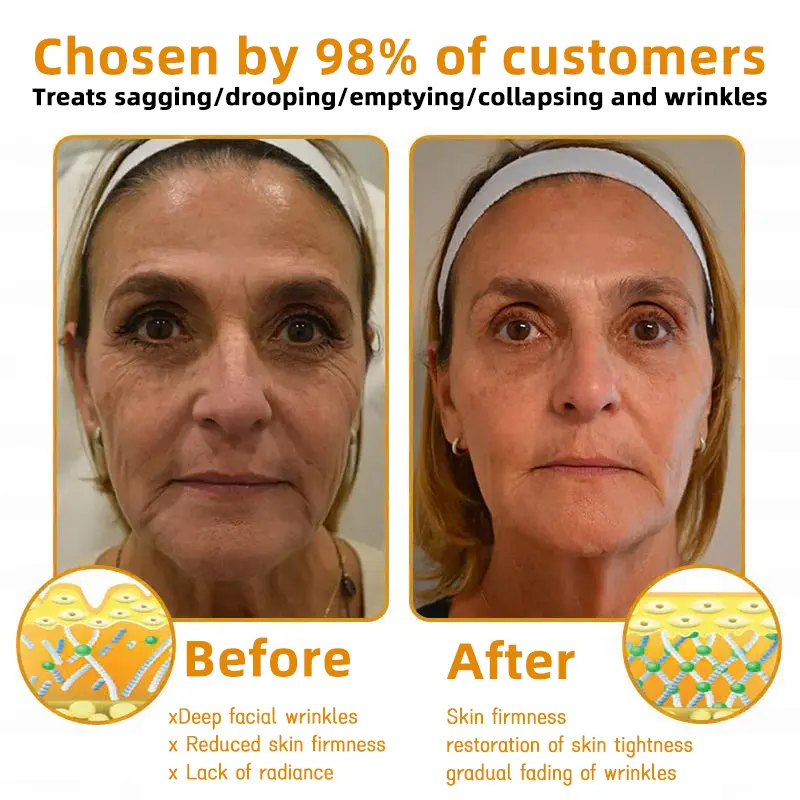 🐝Bee Poison Skin Restoration Cream 🐝 - Image 6