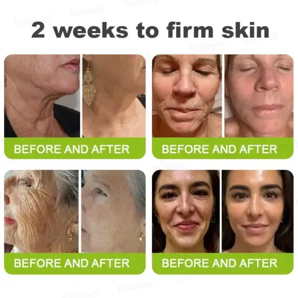 Last Day! 70% OFF 💫 Botox & Vita-A Retinol Wrinkle-Lift Cream – Made & Shipped from CA 🔥 - Image 7