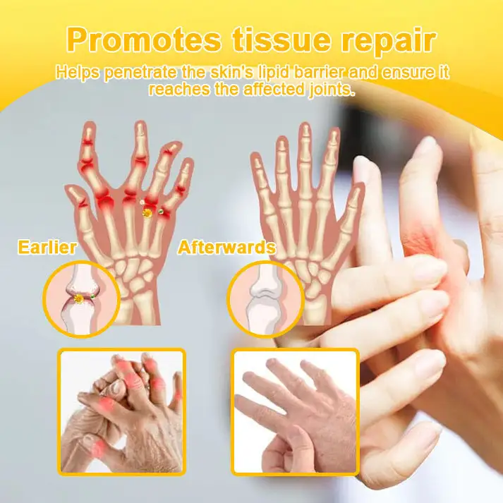Botulinum Toxin & Bee Venom Pain-Relief Bone Healing Cream - Image 15