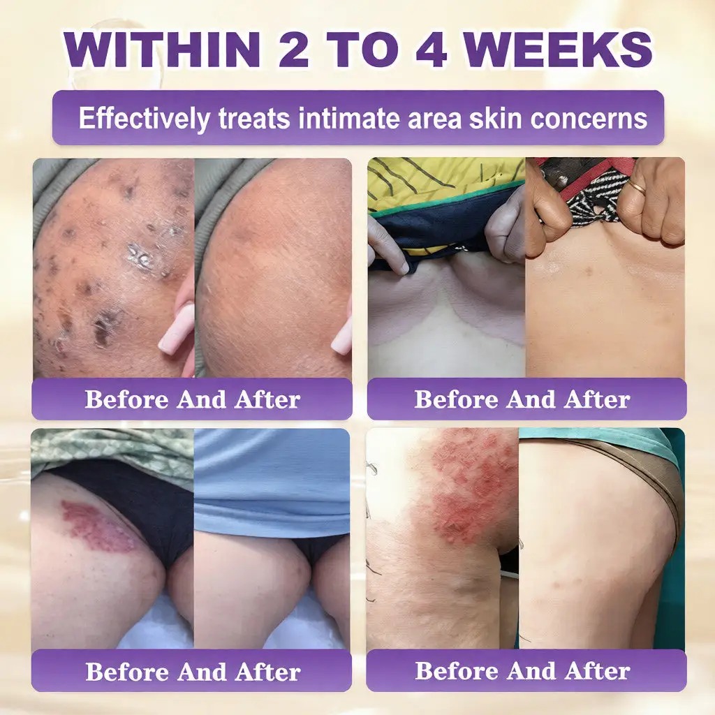 Biotin 10-in-1 Skin Restoration Cream - Image 5