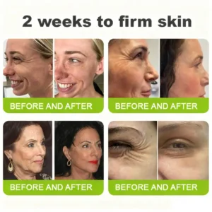 Alternative view of 👏🌿Made and shipped from the USA Botox & Vita-A Retinol Shot Wrinkle-Lift Tightening cream - Last Day Promotion 70% OFF
