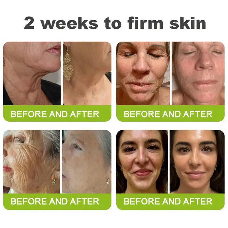 🧠👨⚕️Made and shipped from the USA Skin Tightening & Vita-A Retinol Retinol shot Anti-Wrinkle Firming Tightening cream - Last Day Promotion 65% OFF---- - Image 7